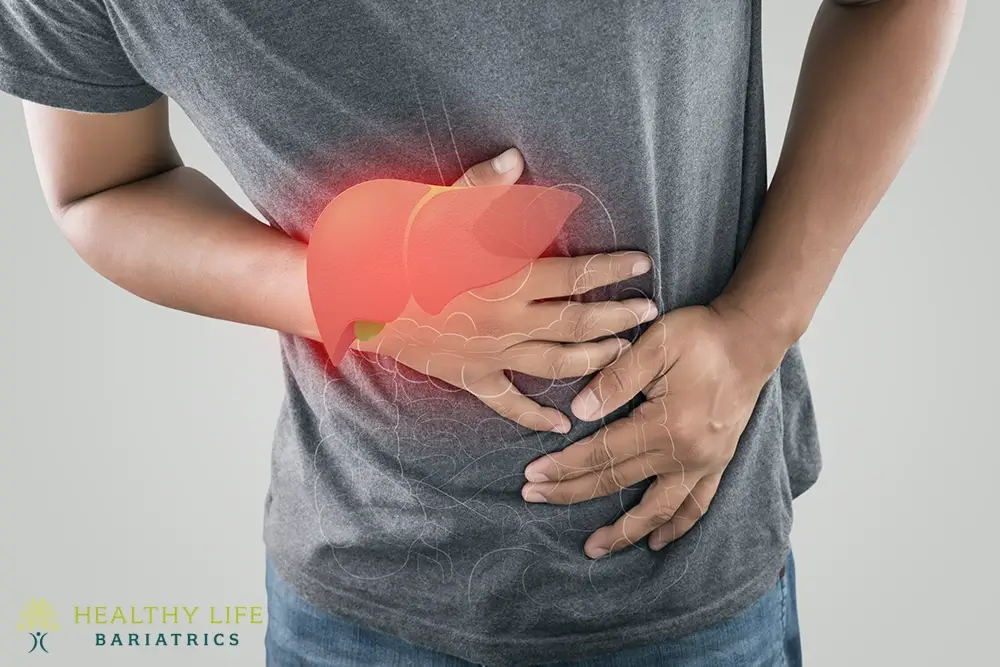 Cholecystectomy for Painful Gallstones in Los Angeles CA