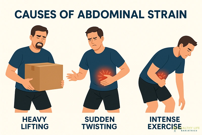 Common Causes of Abdominal Strain
