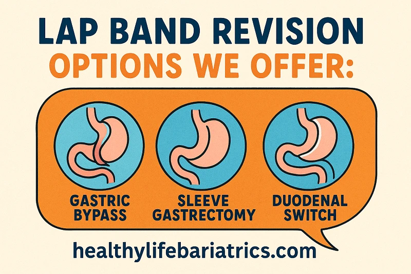 Lap Band Revision Options We Offer in Los Angeles Lap Band Revision Options We Offer in Los Angeles