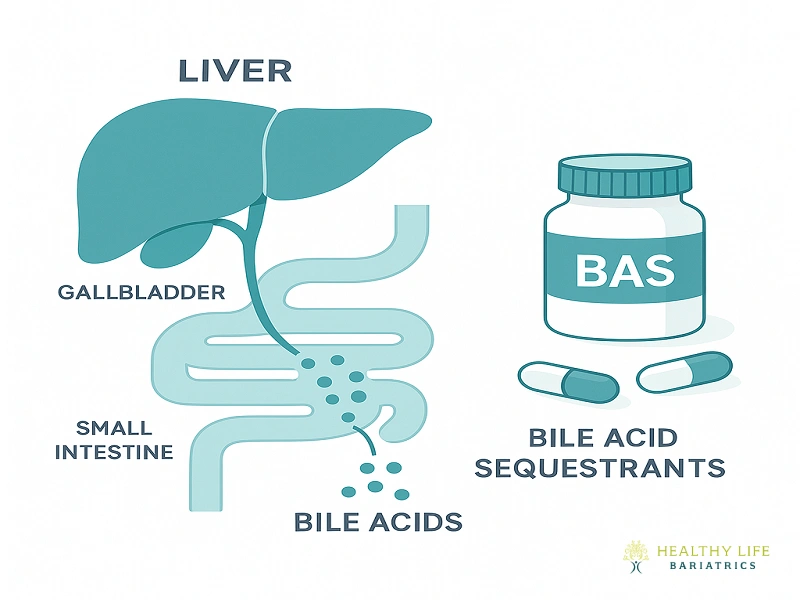 Bile acid sequestrants for Gallbladder Removal