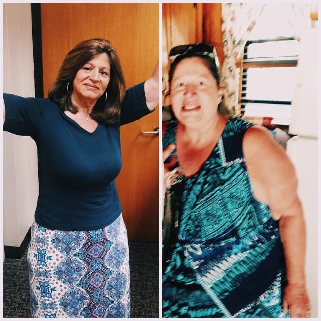 Before and after bariatric weight loss surgery, female patient transformation - Healthy Life Bariatrics, Los Angeles